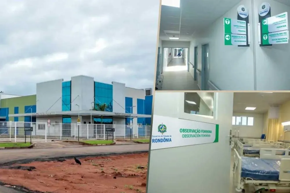Gestão do Hospital de Guajará-Mirim manifesta preocupação com edital do governo que reduz em 82,7% a meta de cirurgias ortopédicas na unidade