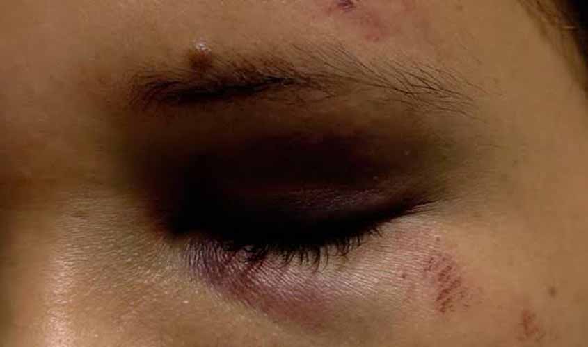 Imagem meramente ilustrativa